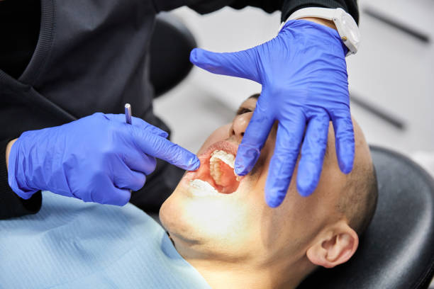 Best Emergency Wisdom Teeth Removal in Doraville, GA
